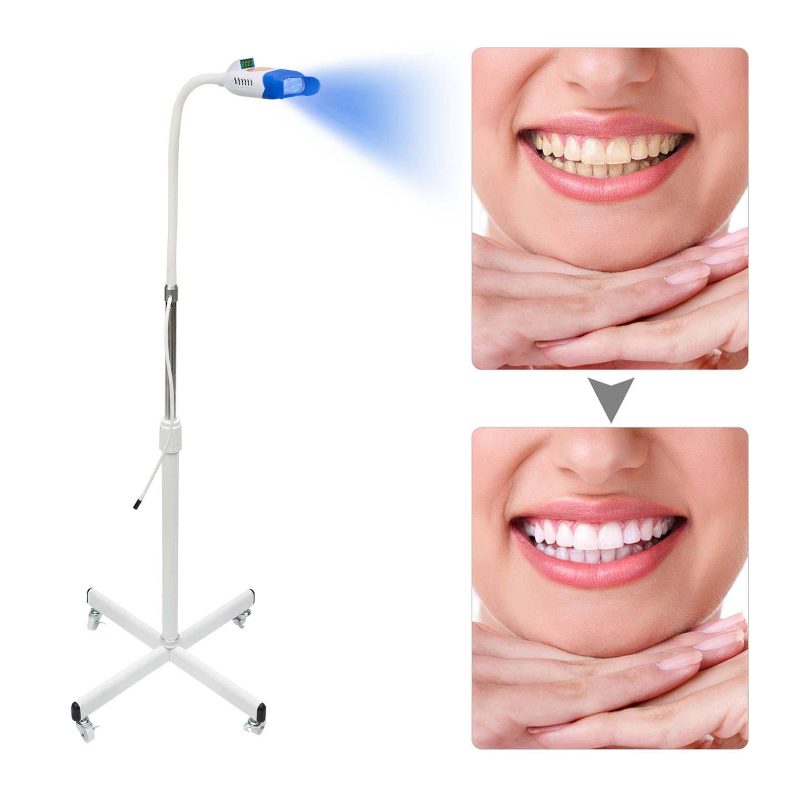 Professionelle Zahnaufhellungsmaschine mit LED-Licht, 36W mobile Dentallampe Professionelle Zahnaufhellungsmaschine mit LED-Licht, 36W mobile Dentallampe